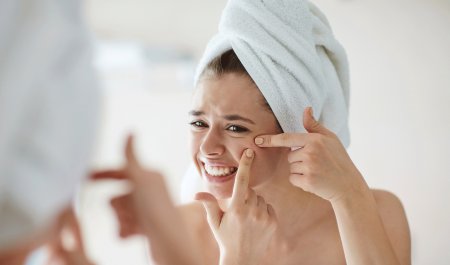 Your Skin - Teen Mirror Acne